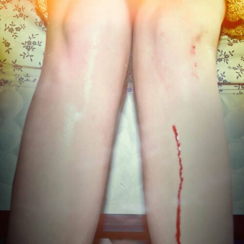 Los campesinos!