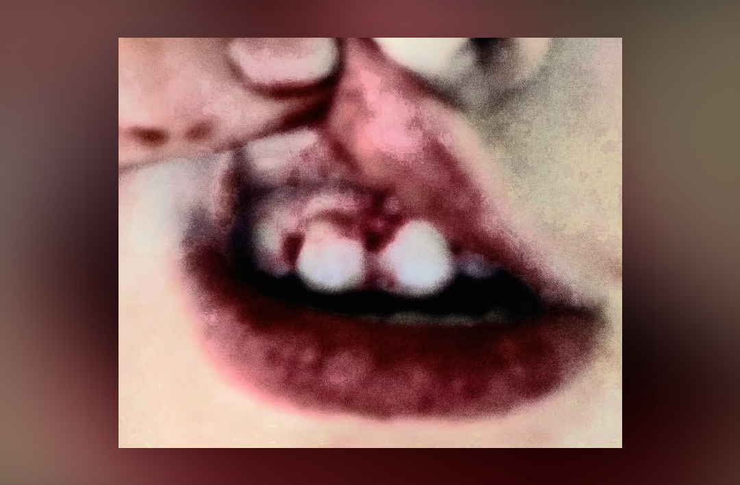 Bloody mouth with hand holding lip