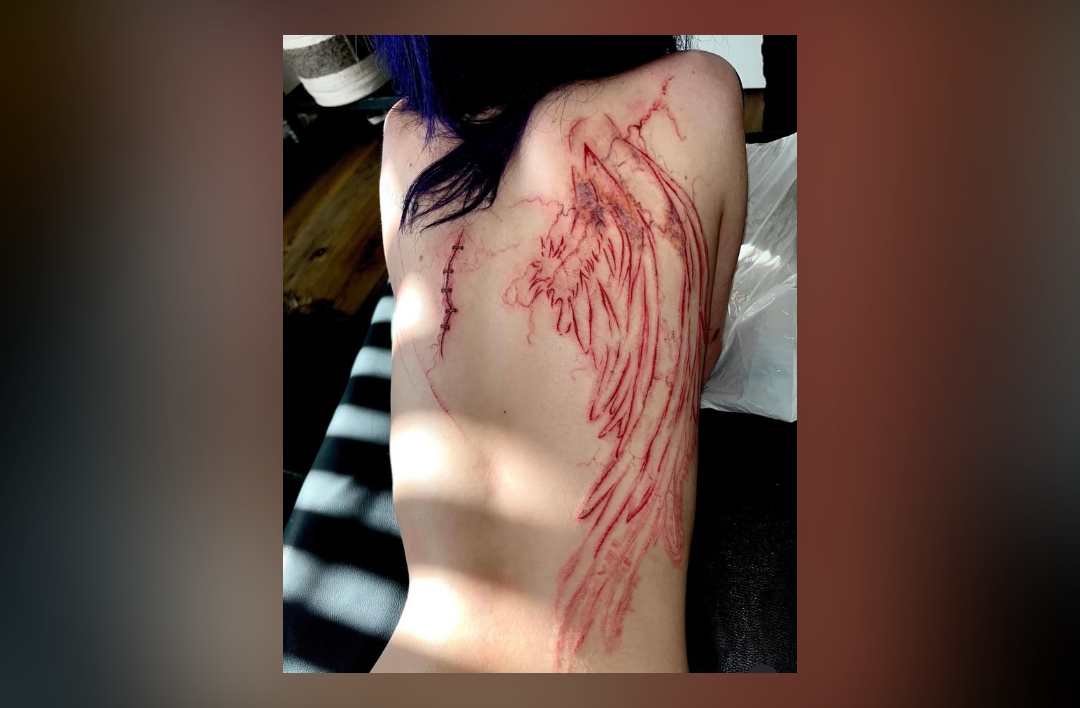 Back with scar tattoo