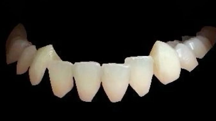 bottomteeth