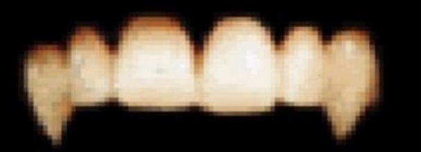 topteeth